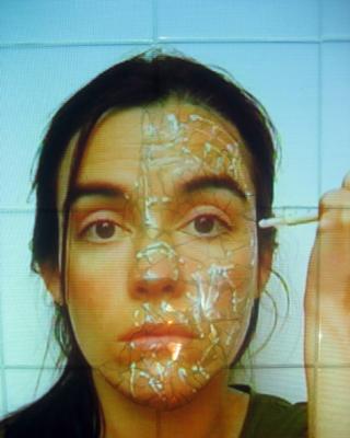 Botox Botox