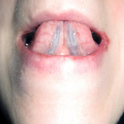 saliva - 10 saliva - 10