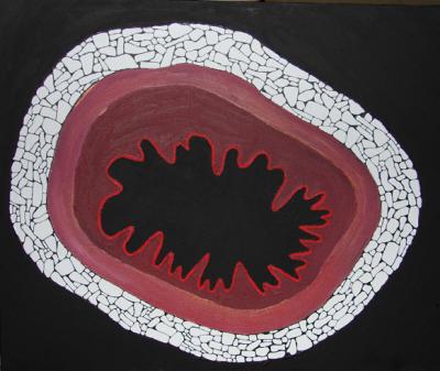 Eruption Eruption