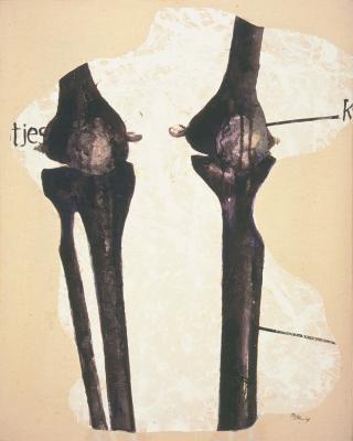 Knekel-torso Knekel-torso