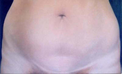navel navel